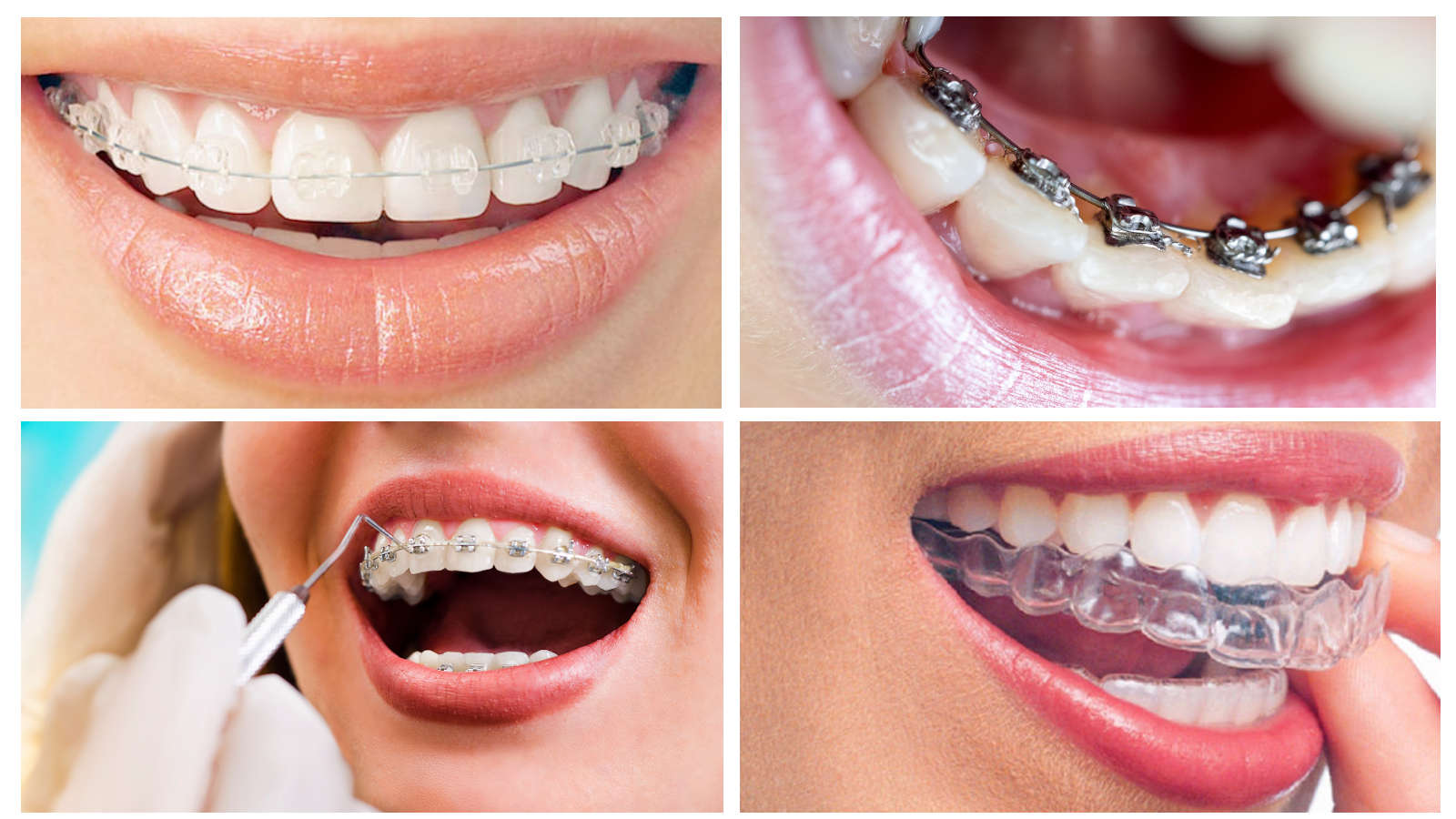 خدمات Tooth Guard للأسنان